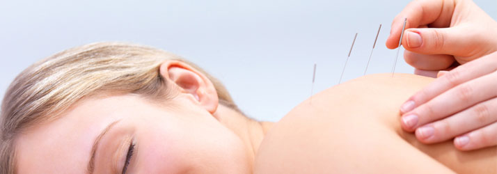 Chiropractic Kansas City MO Acupuncture Back Chiropractic Kansas City MO Acupuncture Back