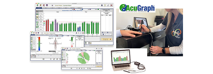 Chiropractic Liberty MO AcuGraph Technology Chiropractic Liberty MO AcuGraph Technology